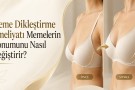 Meme Dikleştirme Ameliyatı Memelerin Konumunu Nasıl Değiştirir?