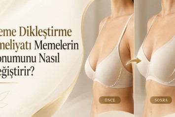 Meme Dikleştirme Ameliyatı Memelerin Konumunu Nasıl Değiştirir?