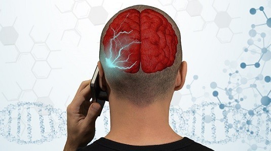 En Düşük Sar Değerine Sahip 10 Akıllı Telefon