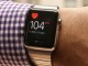 Yeni nesil Apple Watch serisi, EKG çekebilecek